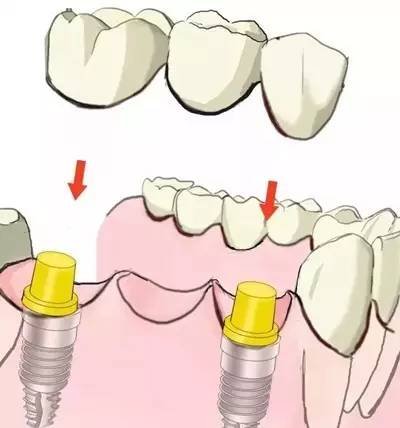 https://img.miyanlife.com/timg/160822/1J3403114-6.jpg