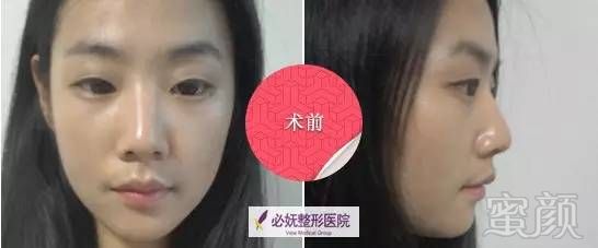 https://img.miyanlife.com/timg/160823/005025O39-0.jpg