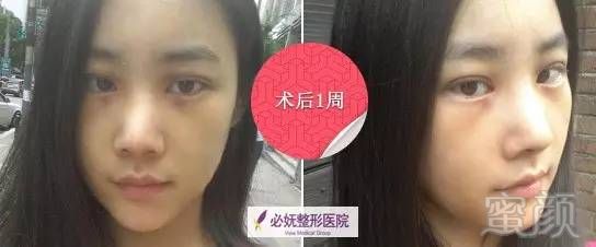 https://img.miyanlife.com/timg/160823/00502CJ6-1.jpg