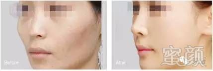 https://img.miyanlife.com/timg/160824/1403511Y9-6.jpg