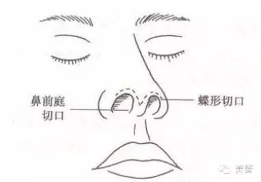 https://img.miyanlife.com/timg/160824/140353J41-15.jpg