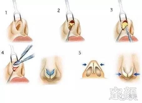 https://img.miyanlife.com/timg/160825/233G5BX-4.jpg