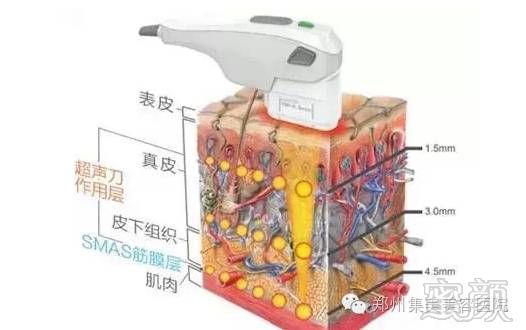 案例图片