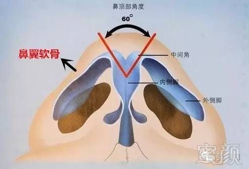 https://img.miyanlife.com/timg/160826/21120145J-11.jpg