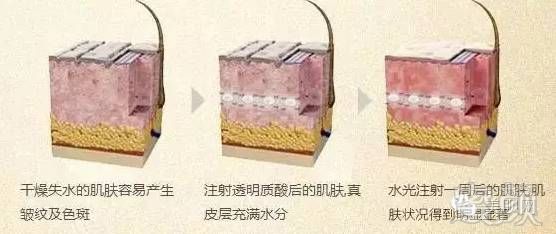 https://img.miyanlife.com/timg/160829/001U04P9-12.jpg