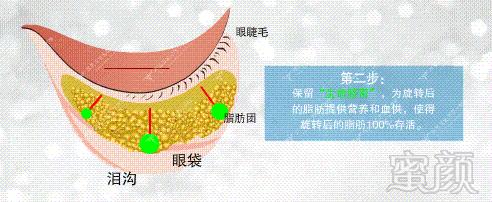 案例图片