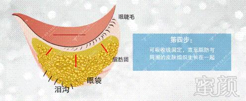 案例图片