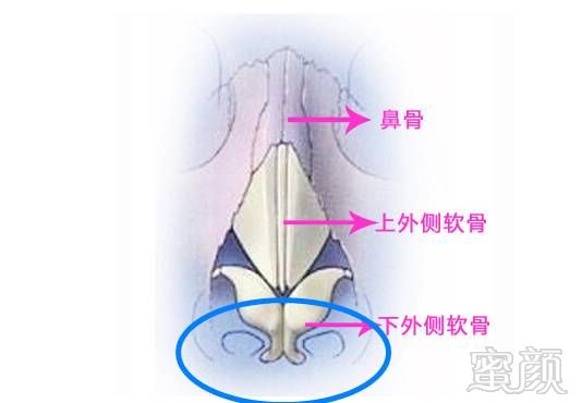https://img.miyanlife.com/timg/160830/110I535a-2.jpg 案例图片