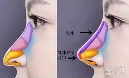 https://img.miyanlife.com/timg/160830/110I63231-6.jpg 案例图片