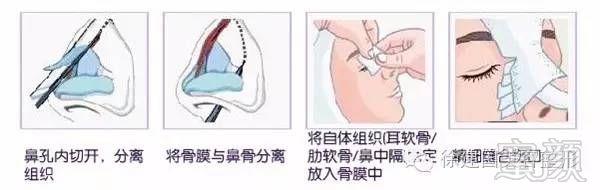 https://img.miyanlife.com/timg/160830/110II619-7.jpg 案例图片