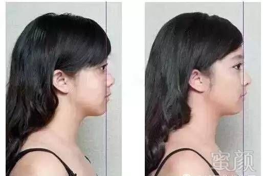 https://img.miyanlife.com/timg/160830/113502F93-3.jpg