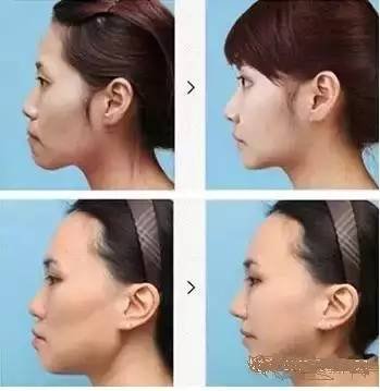 https://img.miyanlife.com/timg/160830/1135035430-4.jpg
