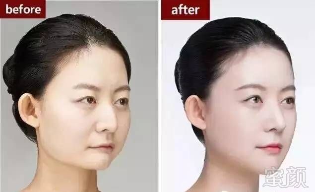 https://img.miyanlife.com/timg/160830/1135035B1-5.jpg