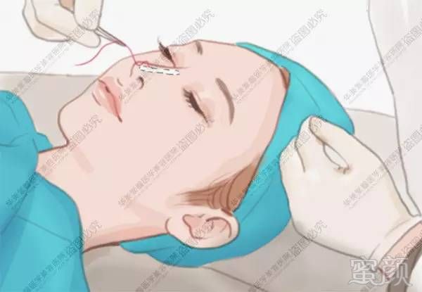 https://img.miyanlife.com/timg/160831/002Q540H-3.jpg