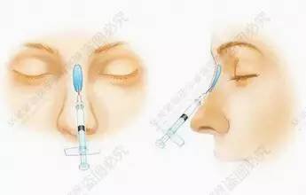 https://img.miyanlife.com/timg/160831/002QM251-7.jpg