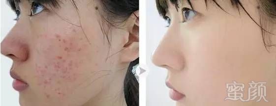 https://img.miyanlife.com/timg/160831/2042061529-9.jpg