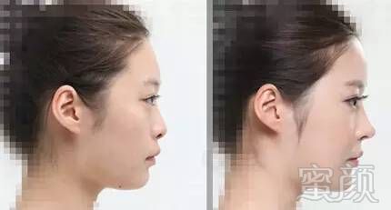 https://img.miyanlife.com/timg/160831/2042062414-7.jpg