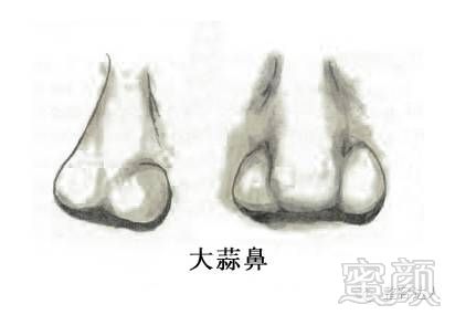 https://img.miyanlife.com/timg/160901/2002463150-5.jpg