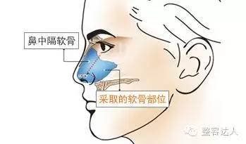 https://img.miyanlife.com/timg/160901/20024AO5-8.jpg