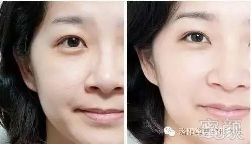 https://img.miyanlife.com/timg/160901/21225511W-11.jpg
