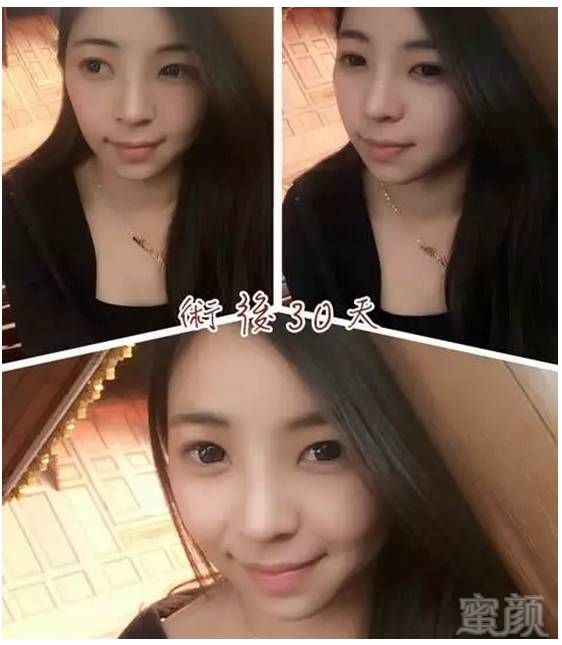 https://img.miyanlife.com/timg/160901/2249503Y0-4.jpg