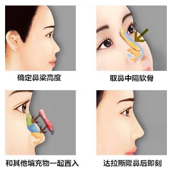 https://img.miyanlife.com/timg/160903/11121I2P-2.jpg