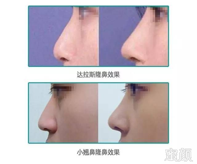 https://img.miyanlife.com/timg/160903/11121K3E-3.jpg