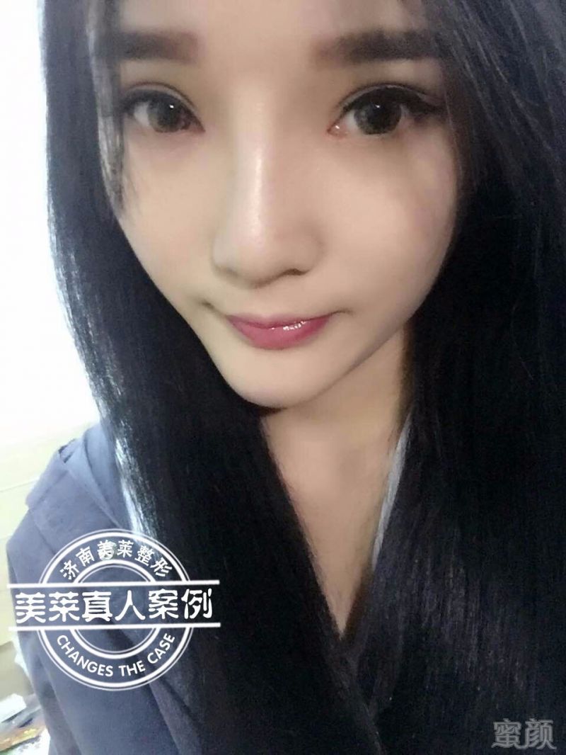 https://img.miyanlife.com/timg/160903/20404259C-2.jpg