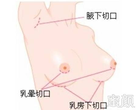 https://img.miyanlife.com/timg/160904/21561U402-5.jpg