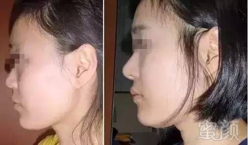https://img.miyanlife.com/timg/160907/1041103327-0.jpg