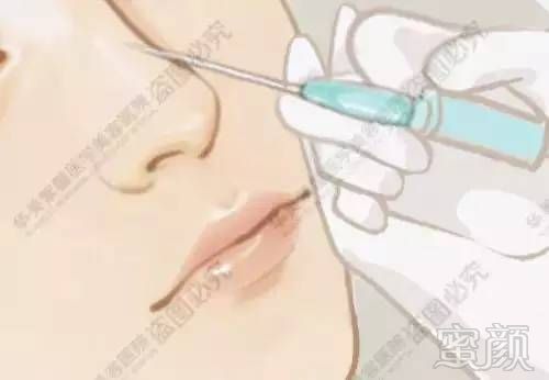 https://img.miyanlife.com/timg/160907/1942062441-6.jpg