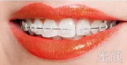 https://img.miyanlife.com/timg/160907/1954464Y5-9.jpg