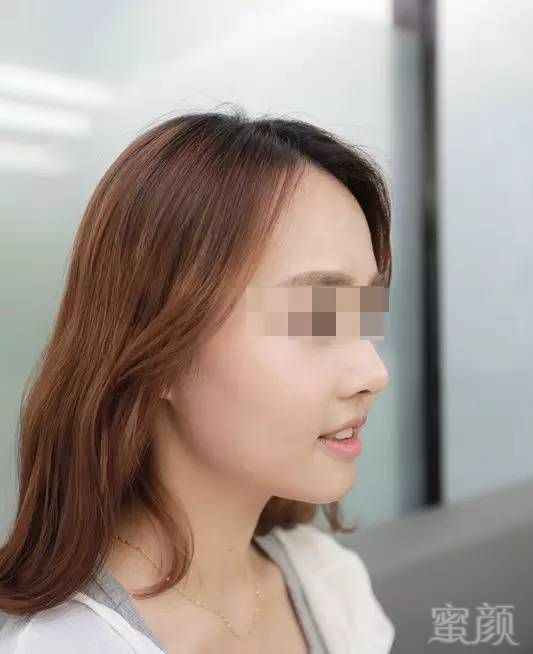 https://img.miyanlife.com/timg/160907/1I2413457-6.jpg