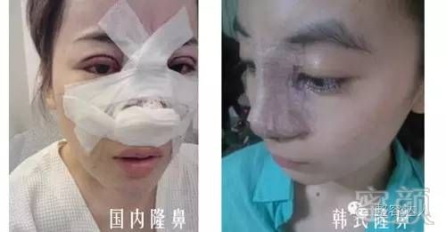 https://img.miyanlife.com/timg/160909/1949131951-4.jpg