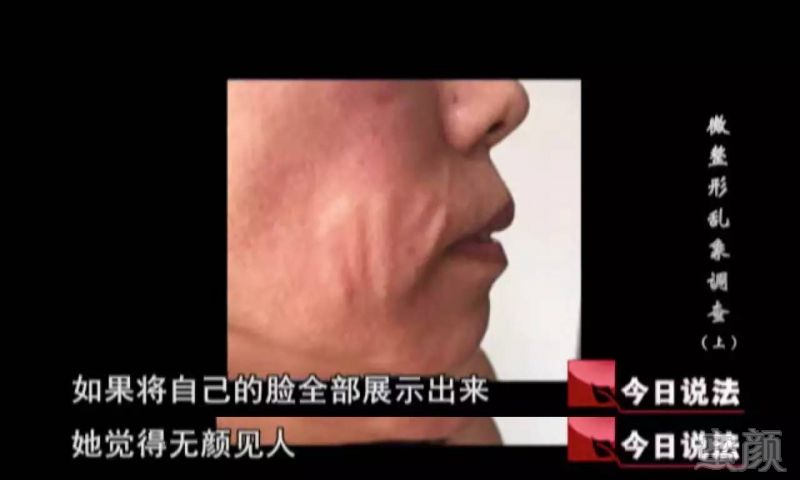 https://img.miyanlife.com/timg/160909/203323O49-5.jpg