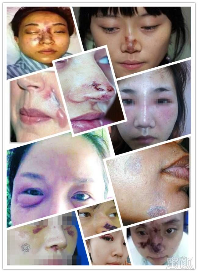 https://img.miyanlife.com/timg/160909/2146046419-12.jpg