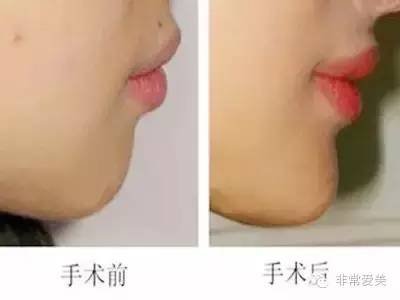 https://img.miyanlife.com/timg/160909/22192Q2M-11.jpg
