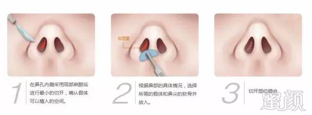 https://img.miyanlife.com/timg/160910/1G10262T-3.jpg