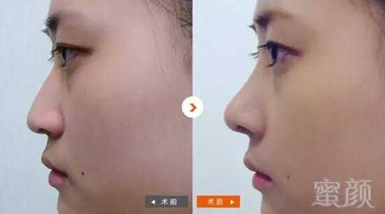 https://img.miyanlife.com/timg/160910/1G102EP-4.jpg