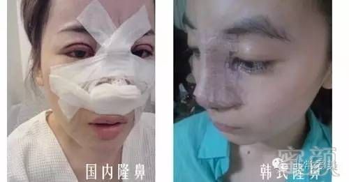 https://img.miyanlife.com/timg/160912/103Z94062-6.jpg