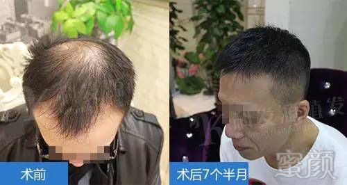 https://img.miyanlife.com/timg/160912/20563B429-0.jpg