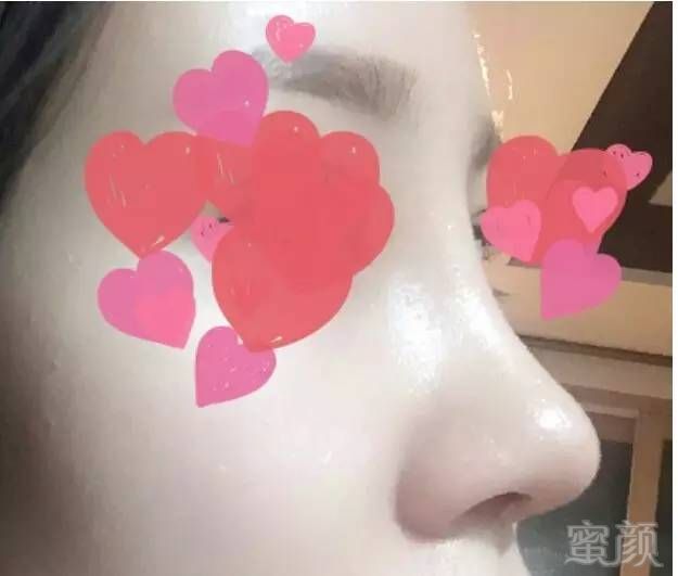 https://img.miyanlife.com/timg/160913/110434C05-1.jpg