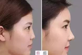 https://img.miyanlife.com/timg/160913/11055HD4-3.jpg
