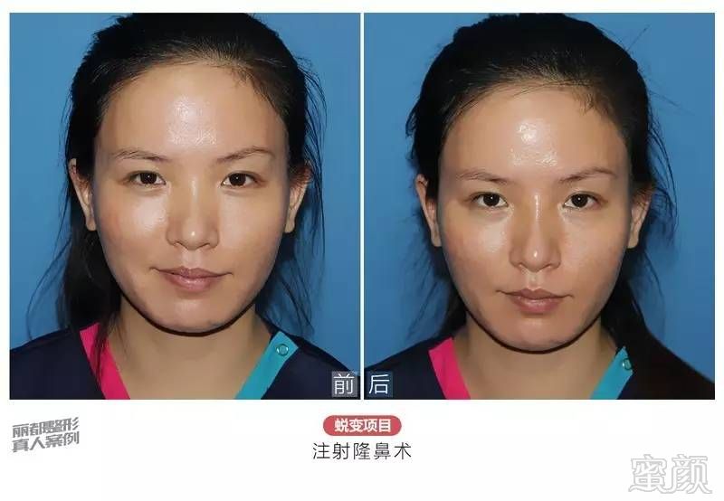 https://img.miyanlife.com/timg/160913/1930215922-8.jpg