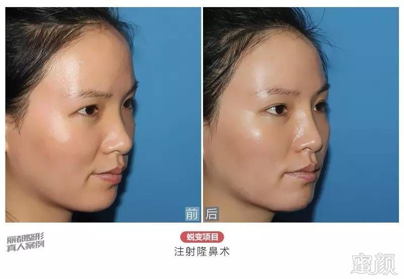 https://img.miyanlife.com/timg/160913/1930222313-9.jpg