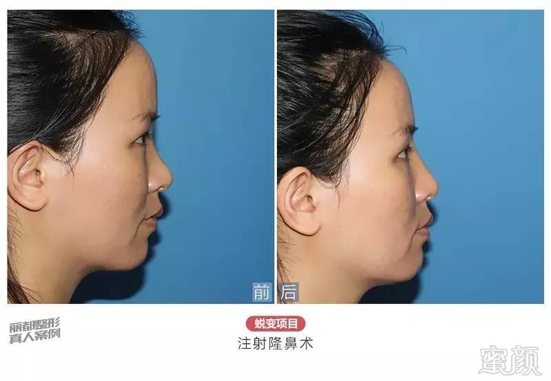 https://img.miyanlife.com/timg/160913/1930224225-10.jpg