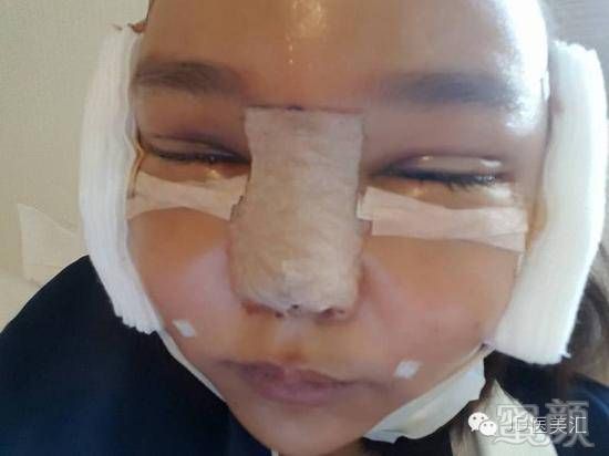 https://img.miyanlife.com/timg/160914/201935IY-4.jpg