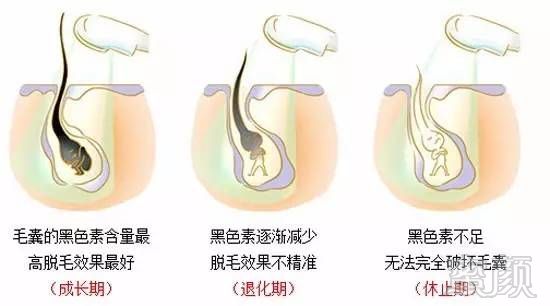 https://img.miyanlife.com/timg/160914/2026242409-0.jpg