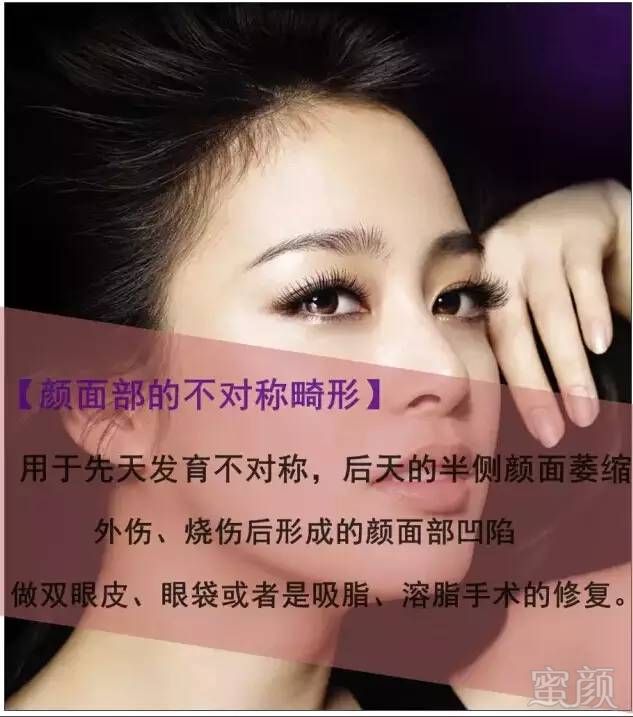 https://img.miyanlife.com/timg/160916/2059563X9-5.jpg