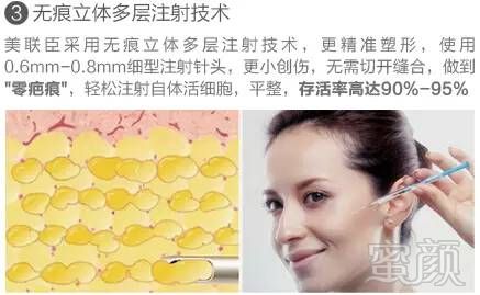 https://img.miyanlife.com/timg/160916/20595I259-8.jpg